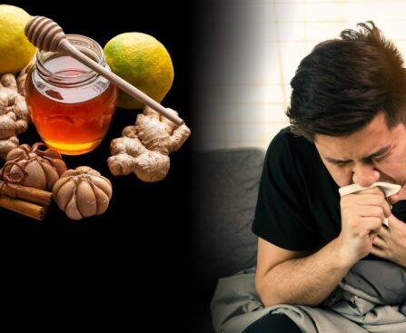 Home Remedies
